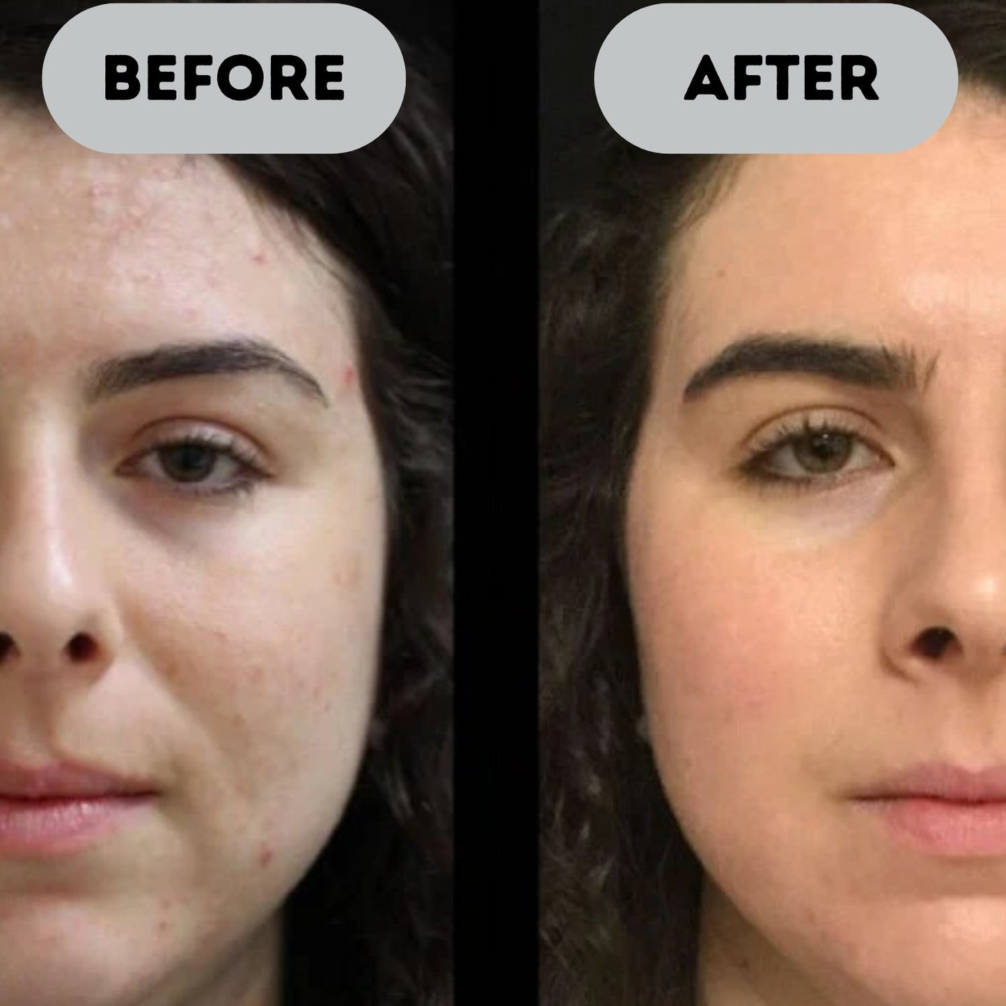 Rejuvix™ - Anti-Aging Booster Pro